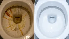 Stačí pouhé 3 kapky a snadno odstraníte rez a vodní kámen z toalety