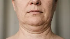 5 cvičení, která pomáhají zbavit se dvojité brady